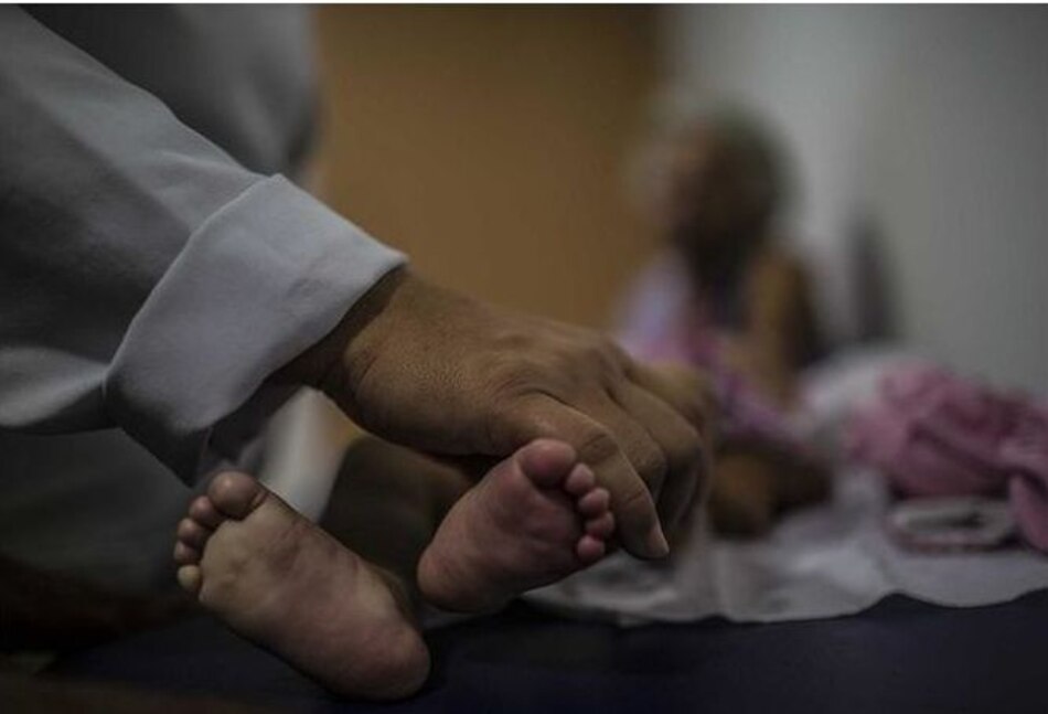 Muere bebé con microcefalia causada por el virus zika en Panamá