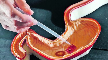 Crean robot ingerible capaz de cerrar heridas