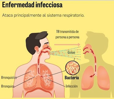 Tuberculosis: enfermedad que persiste en áreas indígenas