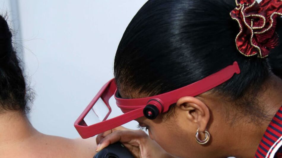 Este martes continúa la campaña de detección temprana del cáncer de piel