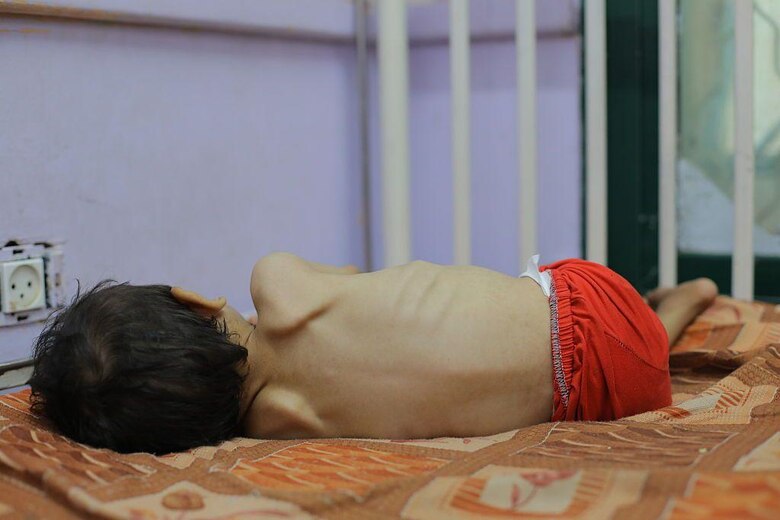 La hambruna se extiende en Gaza: ‘Los niños dicen que desearían morir para poder ir al cielo y comer’