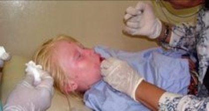 Protectora de la piel del albino guna