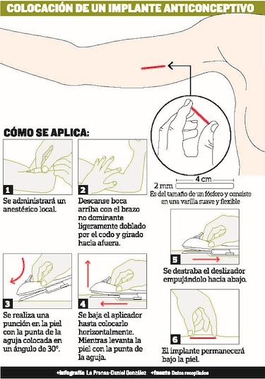 Amplían métodos de planificación familiar