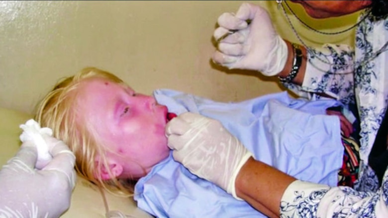 Gaudiano, custodia de la piel albina