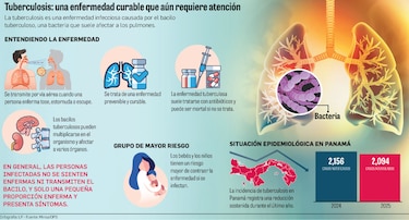 Tuberculosis en Panamá: Estas son las regiones donde se concentra la enfermedad
