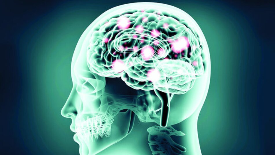 La contaminación afectaría el cerebro