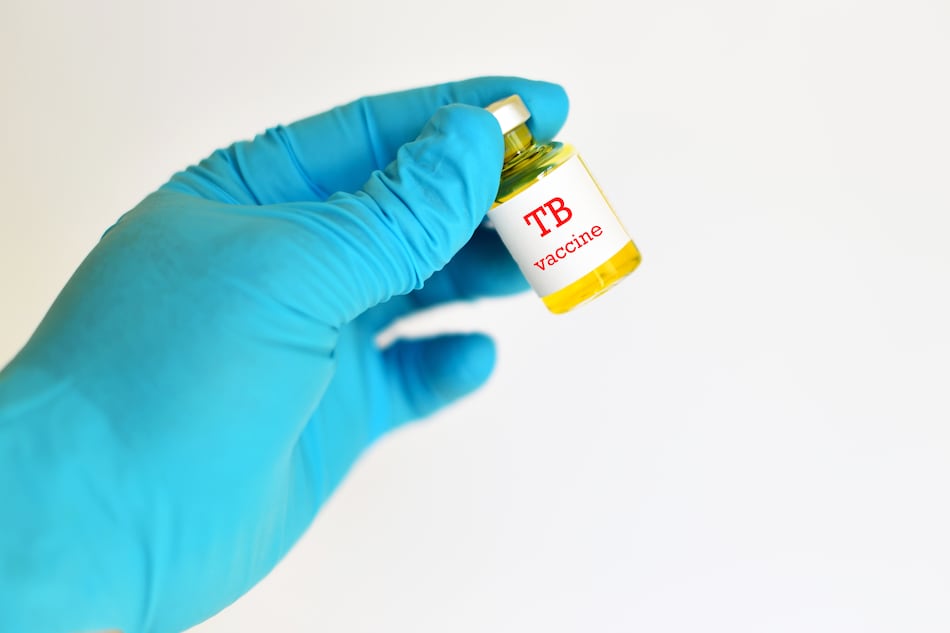 OMS lanza plan para acelerar desarrollo de vacunas contra la tuberculosis