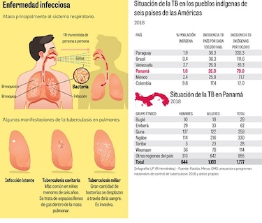 Tuberculosis: enfermedad que persiste en áreas indígenas