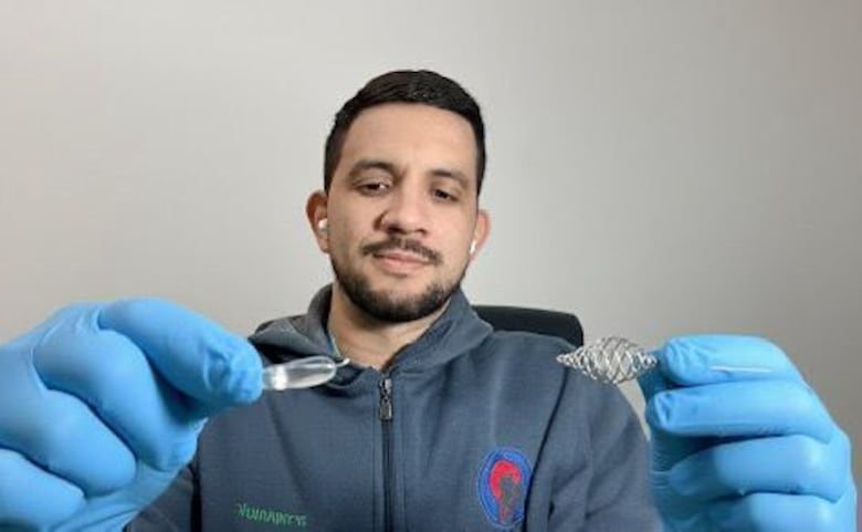 Médico panameño lidera técnica innovadora para tratar vasoespasmo cerebral en Israel
