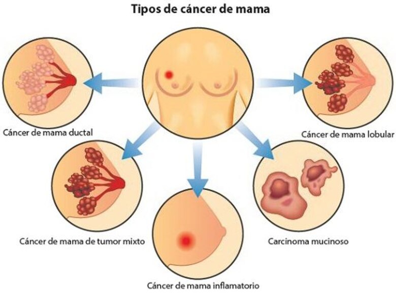 '#YoLucho', un ‘hashtag’ que lucha contra el cáncer