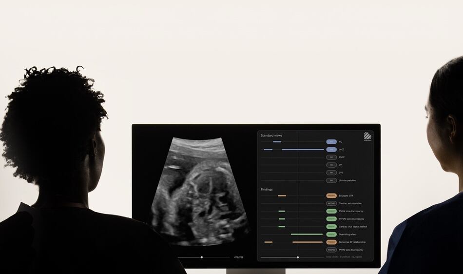 La IA aplicada en medicina: cómo puede ayudar a prevenir enfermedades y detectar cardiopatías en ecografías prenatales