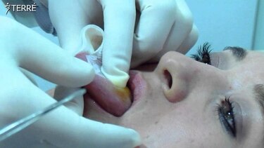 Ministerio de Salud prohíbe en Panamá aplicar la 'malla reductora', un tratamiento para la pérdida de peso