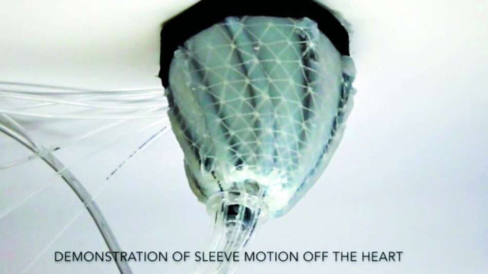 Corazones débiles bombean gracias a funda robótica