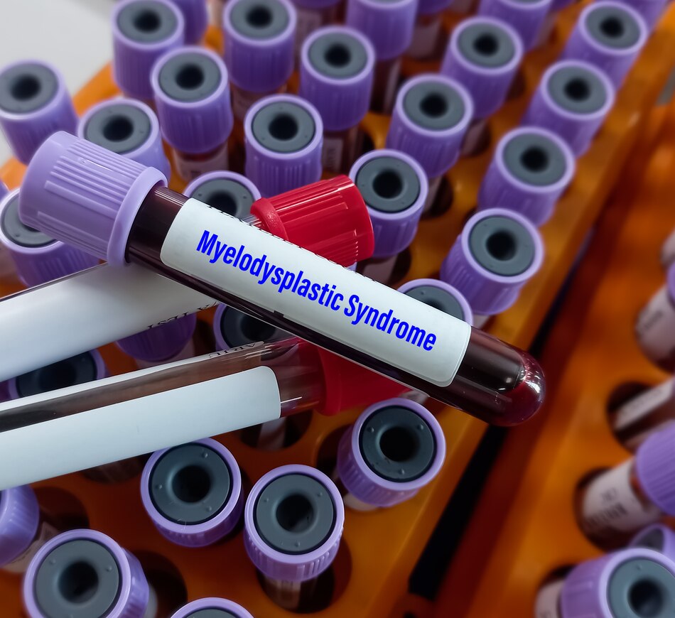 El diagnóstico del presidente Cortizo: ¿qué es el síndrome mielodisplásico?