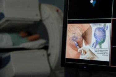 Oncólogos españoles lideran terapia que aumenta supervivencia cáncer mama