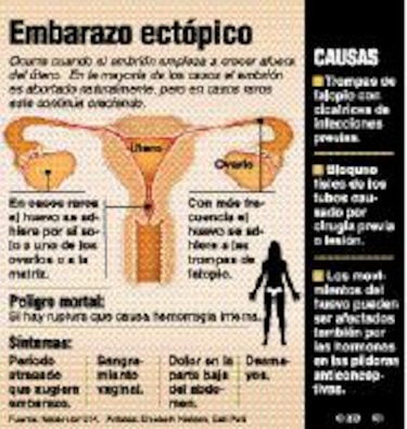 El óvulo fuera de lugar