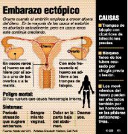 El óvulo fuera de lugar