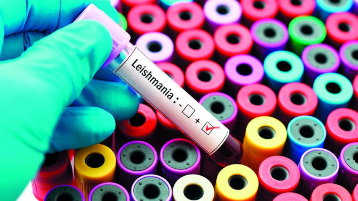 Crema tópica, efectiva contra la leishmaniasis