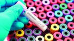 Crema tópica, efectiva contra la leishmaniasis