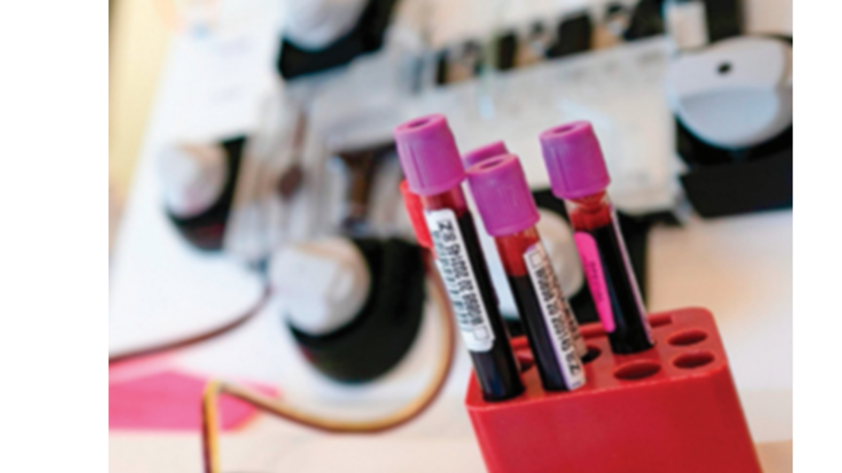 Terapia con plasma convaleciente no tendría beneficios: Universidad de Oxford