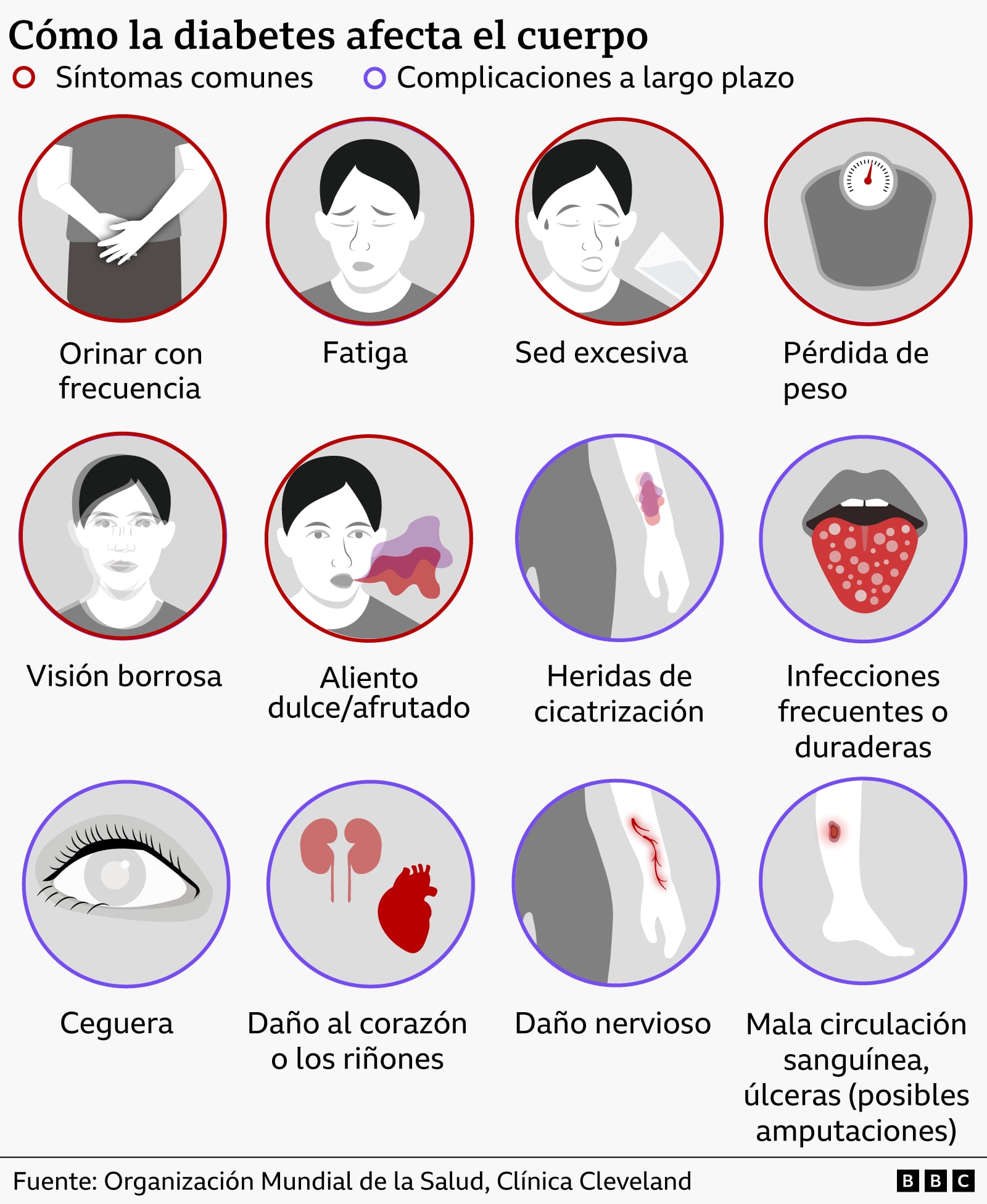 Un gráfico que muestra cómo la diabetes afecta al cuerpo. Los síntomas comunes incluyen la necesidad frecuente de orinar, la fatiga, la sed excesiva, la pérdida de peso, la visión borrosa y el aliento dulce y afrutado. Los síntomas a largo plazo incluyen heridas que cicatrizan lentamente, infecciones frecuentes o duraderas, ceguera, daños en el corazón o los riñones, daños en los nervios y un flujo sanguíneo deficiente. / BBC/OMS/Clínica Cleveland