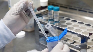 Tuberculosis: detectarla a tiempo salva vidas