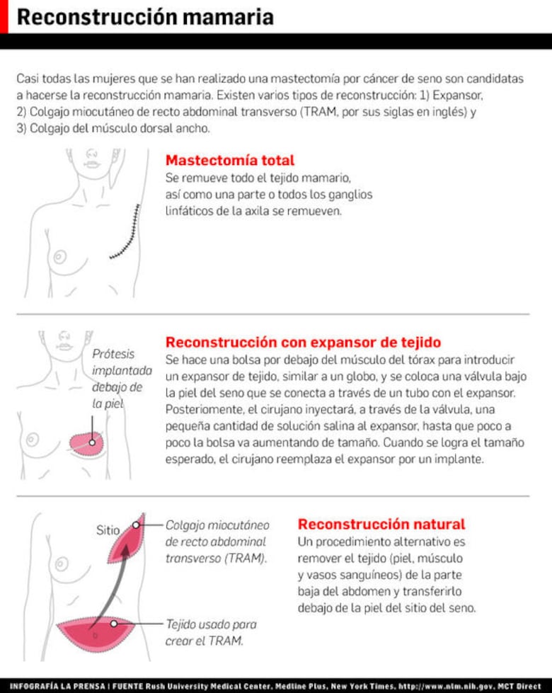 La reconstrucción mamaria, un arte que restaura la feminidad
