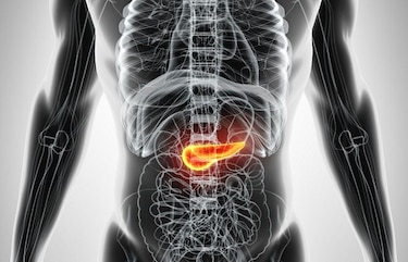 El cáncer de páncreas, un asesino silente