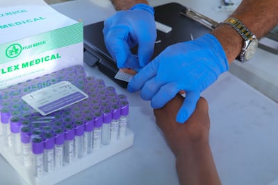 Minsa confirma que sube a 37 los casos de malaria en trabajadores informales que frecuentan Merca Panamá