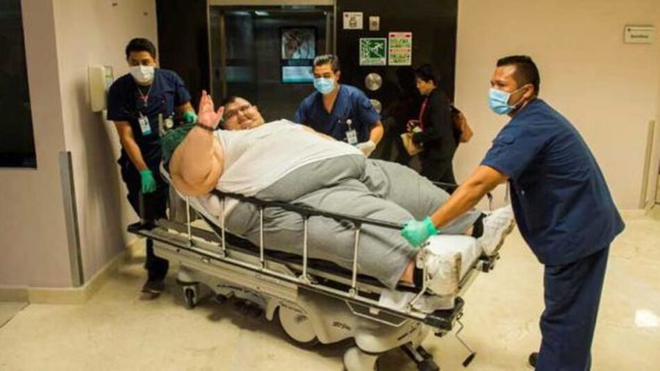 El hombre más obeso del mundo está listo para cirugía en México