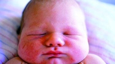 La obesidad infantil, en plena explosión