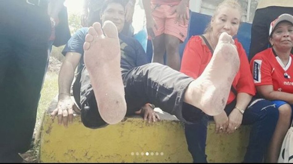 Diputado panameñista Panky Soto camina descalzo por Vacamonte