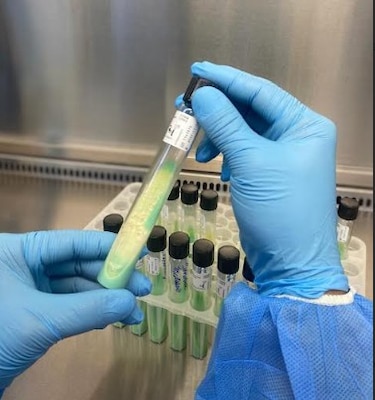 Panamá prevé disminución significativa de casos de tuberculosis en 2025