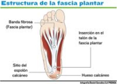Vida saludable Fasceitis plantar y espolón
