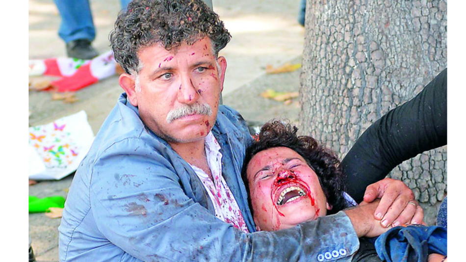 Estallan bombas en la capital turca; 95 fallecidos