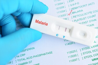 Costa Rica anuncia la contención del brote de malaria en el Caribe