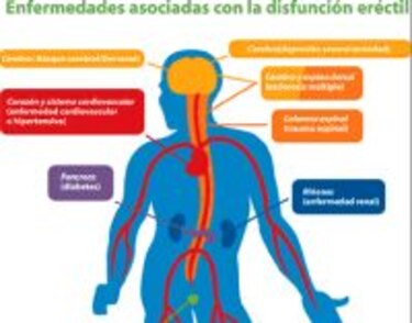 Disfunción eréctil, problema de dos