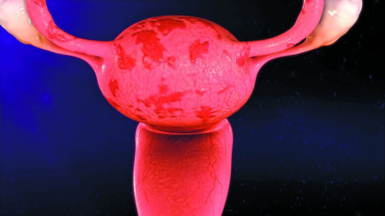 ‘Endoguerreras’ crean conciencia