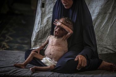 ‘Esos niños parecen muy hambrientos’: Trump contradice a Netanyahu y asegura que la hambruna en Gaza es real