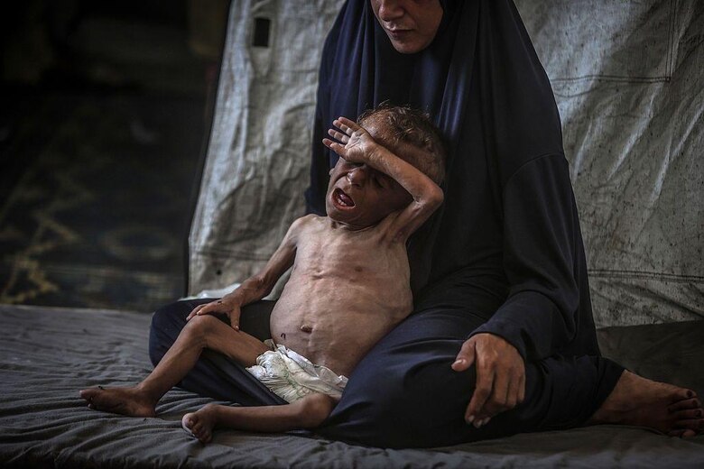 ‘Esos niños parecen muy hambrientos’: Trump contradice a Netanyahu y asegura que la hambruna en Gaza es real