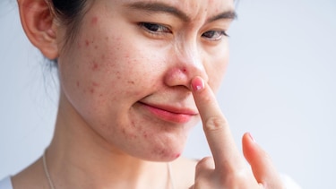 Cómo el estrés afecta a tu piel (y qué puedes hacer al respecto)