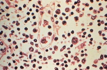 El hantavirus, un virus muy conocido para la ciencia y que nada tiene que ver con el covid