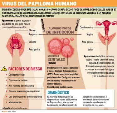 ¿Son seguras las vacunas contra el VPH?