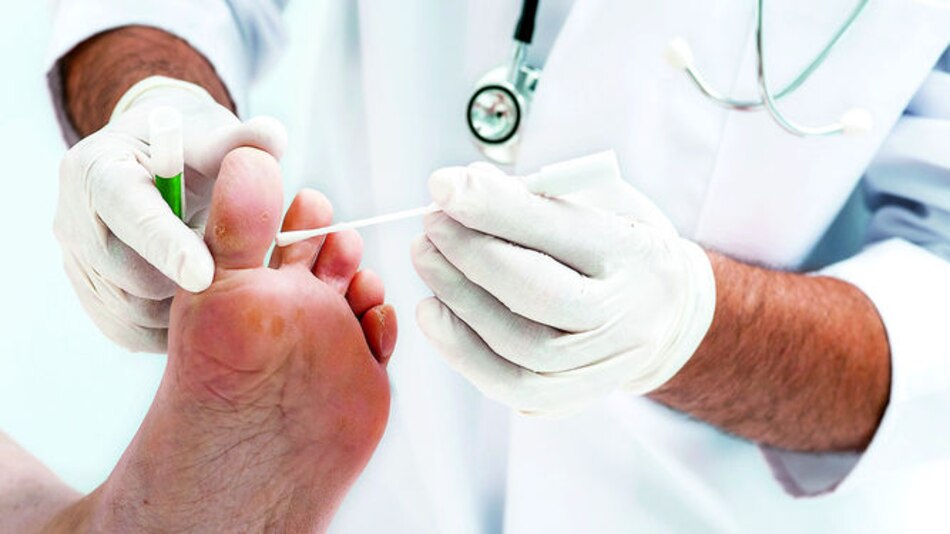 Hongos a flor de piel