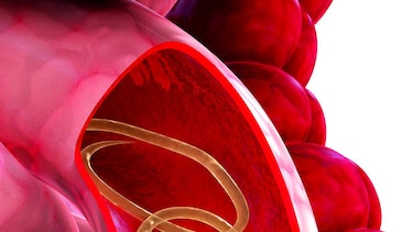 Malestar gastrointestinal: ¿serán parásitos?