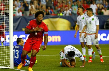 Román Torres, fuera de acción de seis a ocho meses