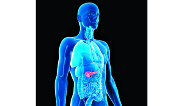 Nueva luz contra el cáncer de páncreas