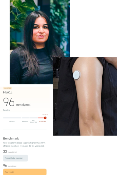 "Me hice un escáner que tomó 2.000 fotos de mi cuerpo y aprendí una inesperada lección sobre mi piel"