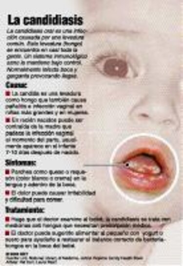 Una infección común