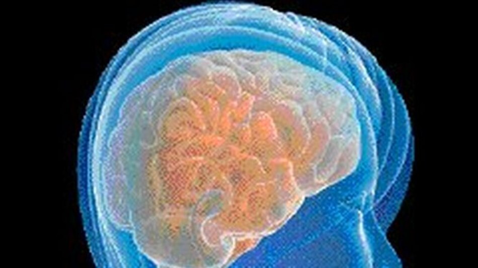 Alzheimer podría achicar el cerebro